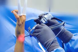 What It Means When Wrist Treatment Is Not Restoring Normal Movement